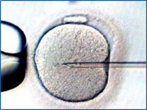 embryo transfer IVF